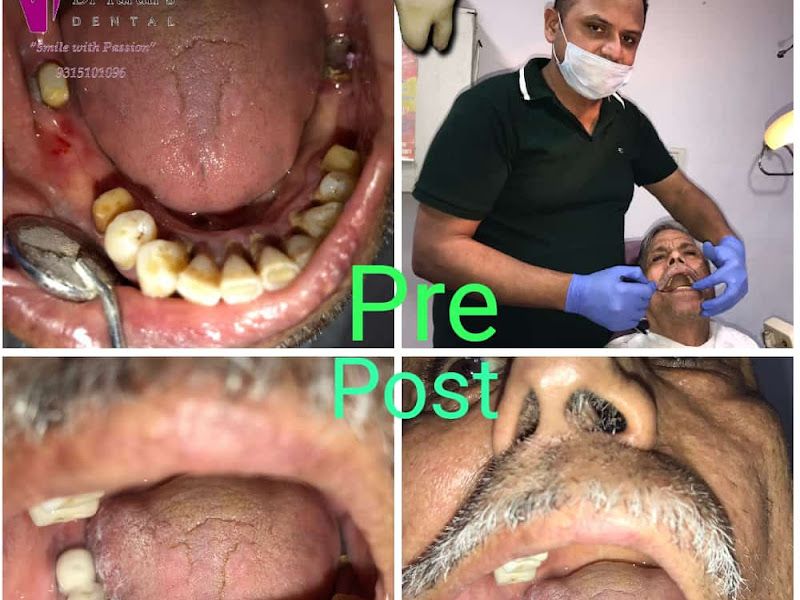 At work — Dr Tarun's Dental - Dentist, Sector 14, Delhi