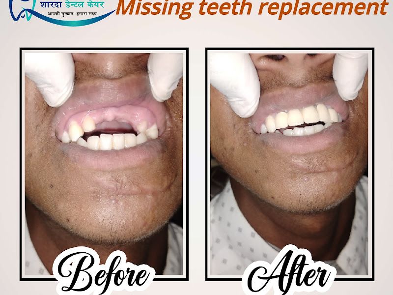Gallery — Sharda Dental care - Best Dental Clinic | Implant Specialist Doctor | Pyorrhea Specialist Doctor, Dhoraiya