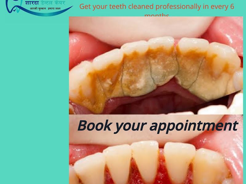 Gallery — Sharda Dental care - Best Dental Clinic | Implant Specialist Doctor | Pyorrhea Specialist Doctor, Dhoraiya