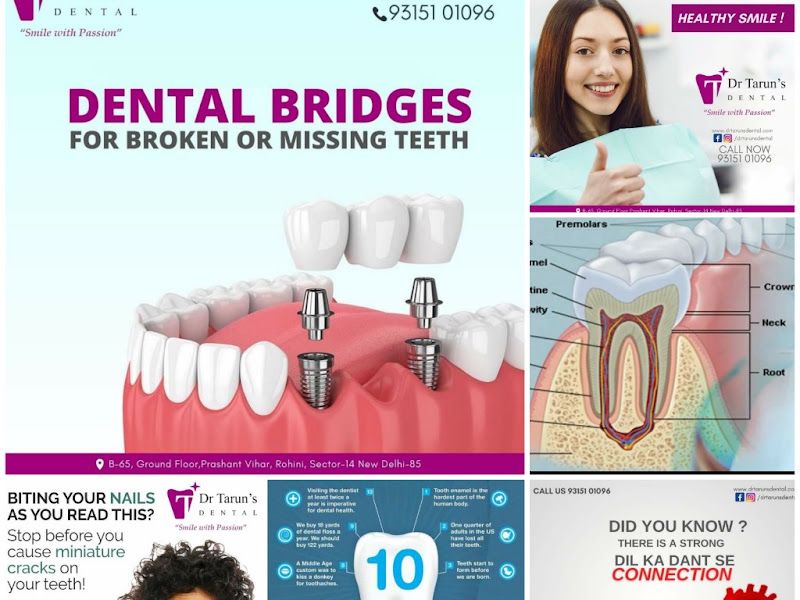 At work — Dr Tarun's Dental - Dentist, Sector 14, Delhi