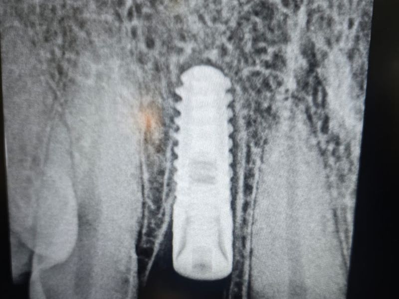 Gallery — Ffigurati Aesthetic and Dental Clinic, Nerul West, Wadhwa