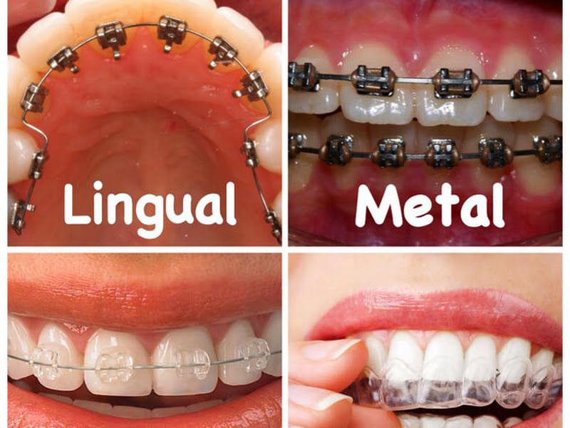 Gallery — Sanjeevni Dental Wellness, Dastur Nagar, Amravati