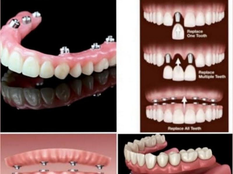 At work — Dr Tarun's Dental - Dentist, Sector 14, Delhi