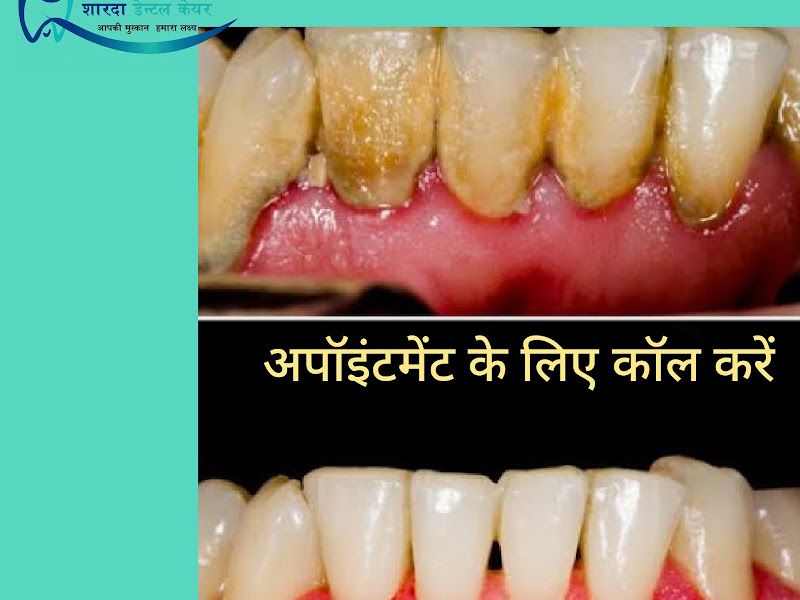 Gallery — Sharda Dental care - Best Dental Clinic | Implant Specialist Doctor | Pyorrhea Specialist Doctor, Dhoraiya