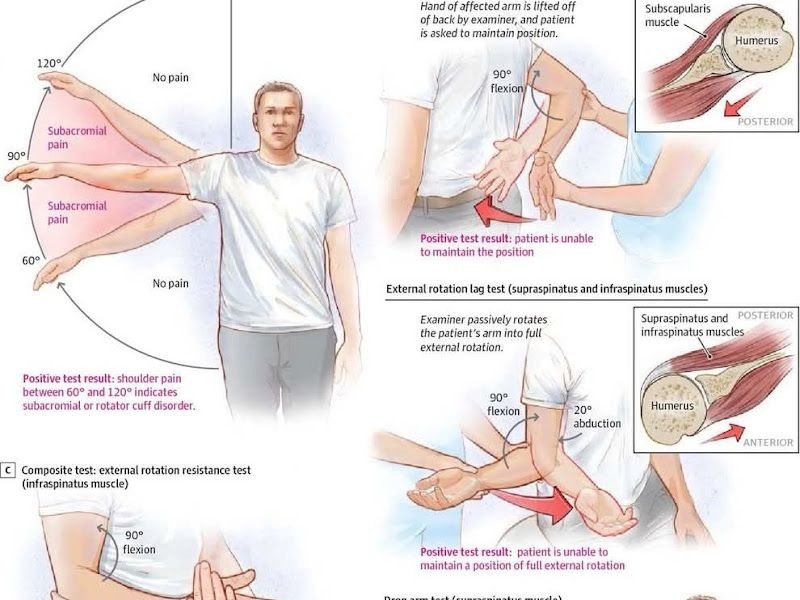 Gallery — Vasu physiotherapy, Varanasi