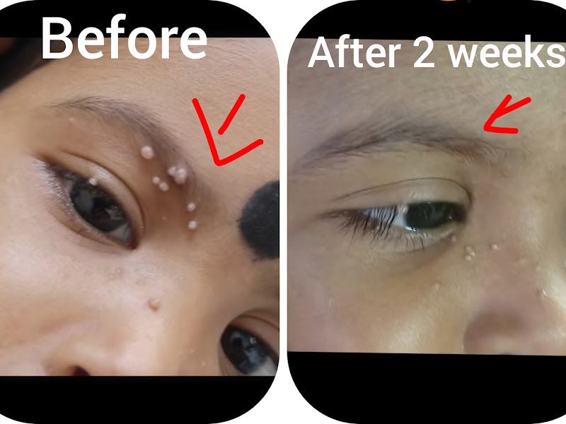 Gallery — Take it easy homeopathic clinic, Old Mahavir Nagar, New Delhi